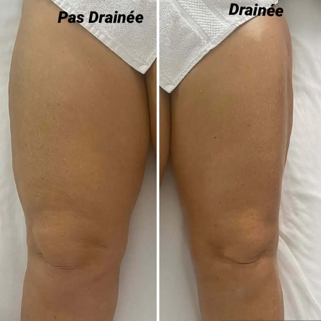 drainage-lymphatique-renata-franca-aix-en-provence-diapo-cube