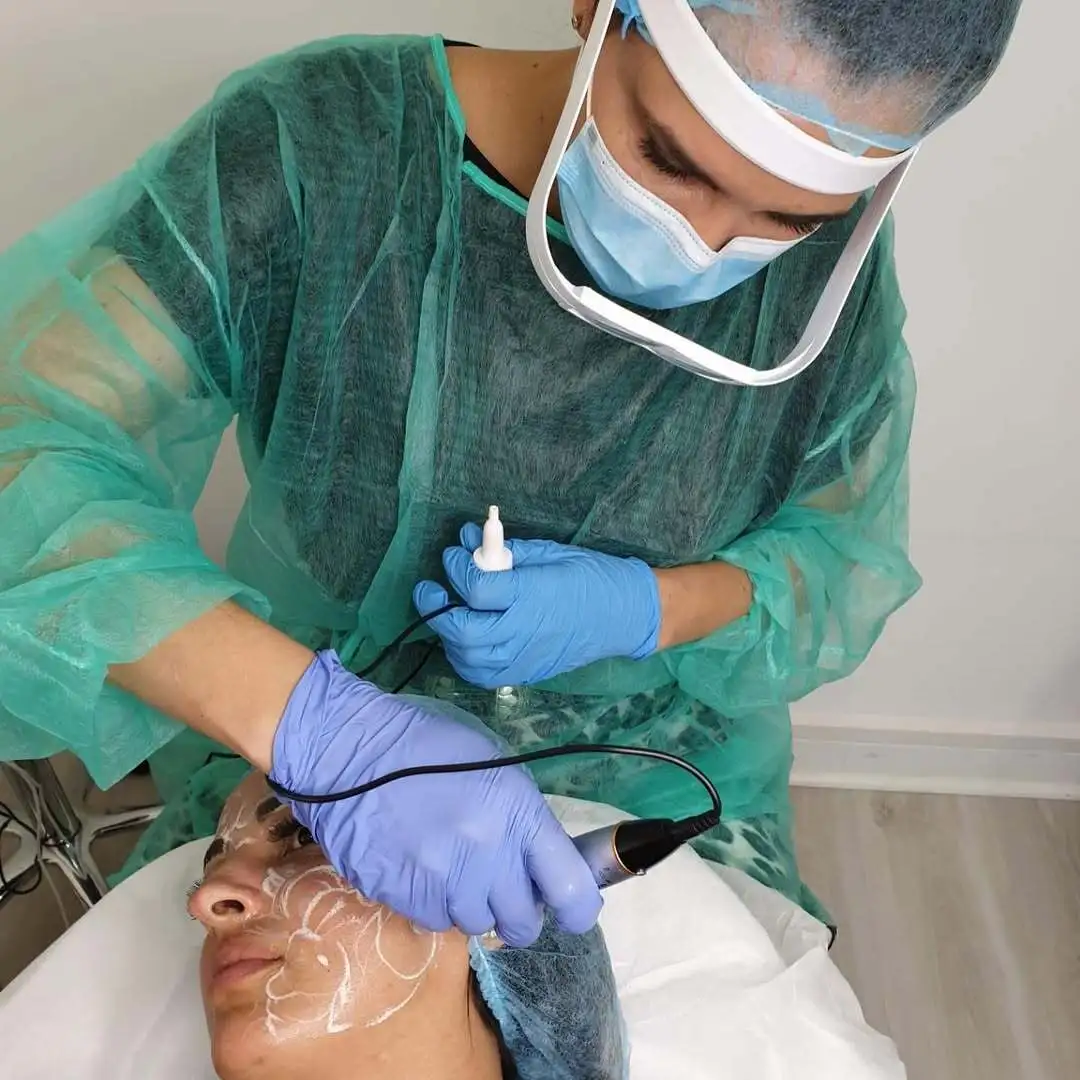 microneedling-aix-en-provence-micro-botox