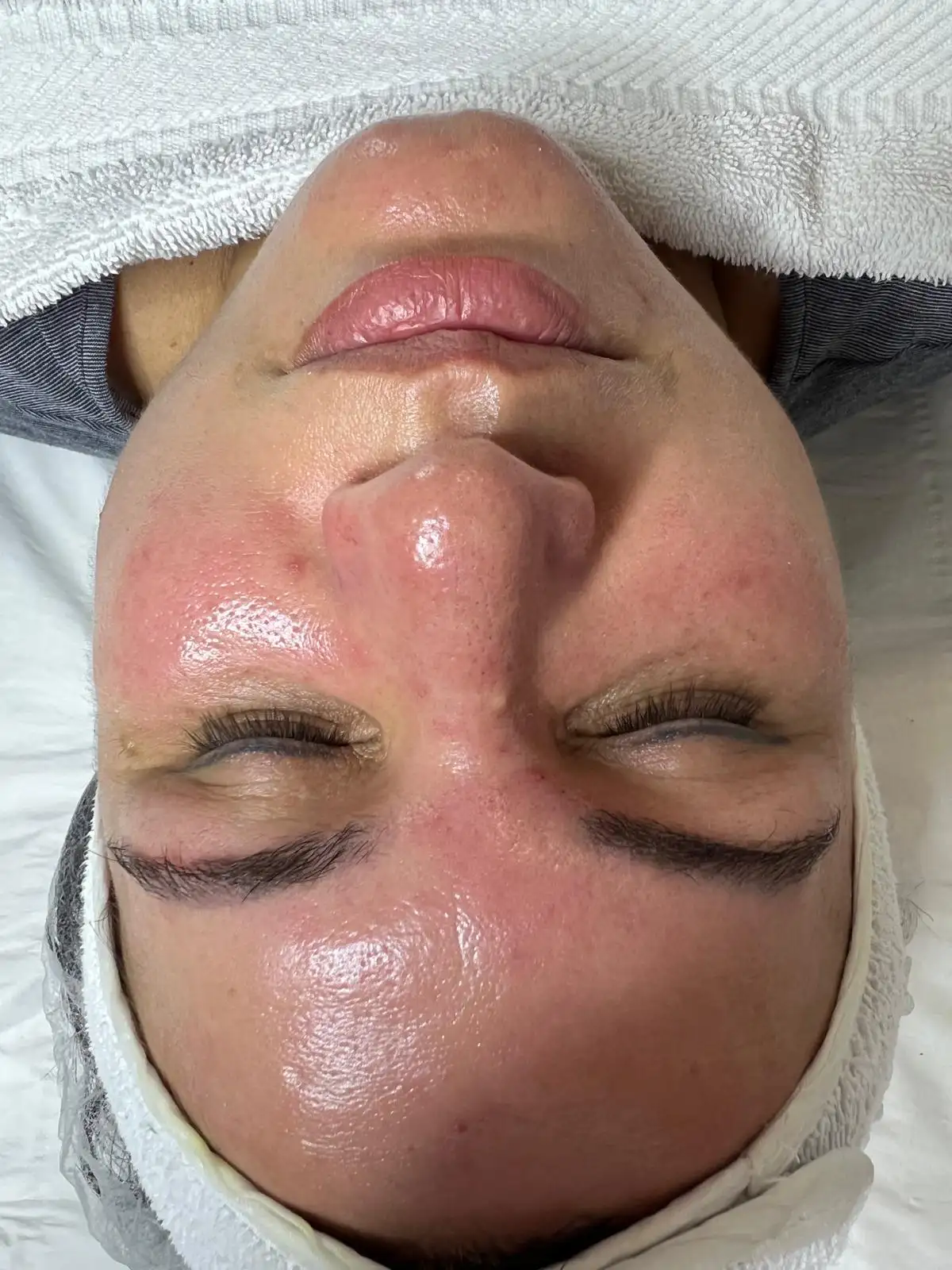 Miracle Face <br>Renata Fran�a