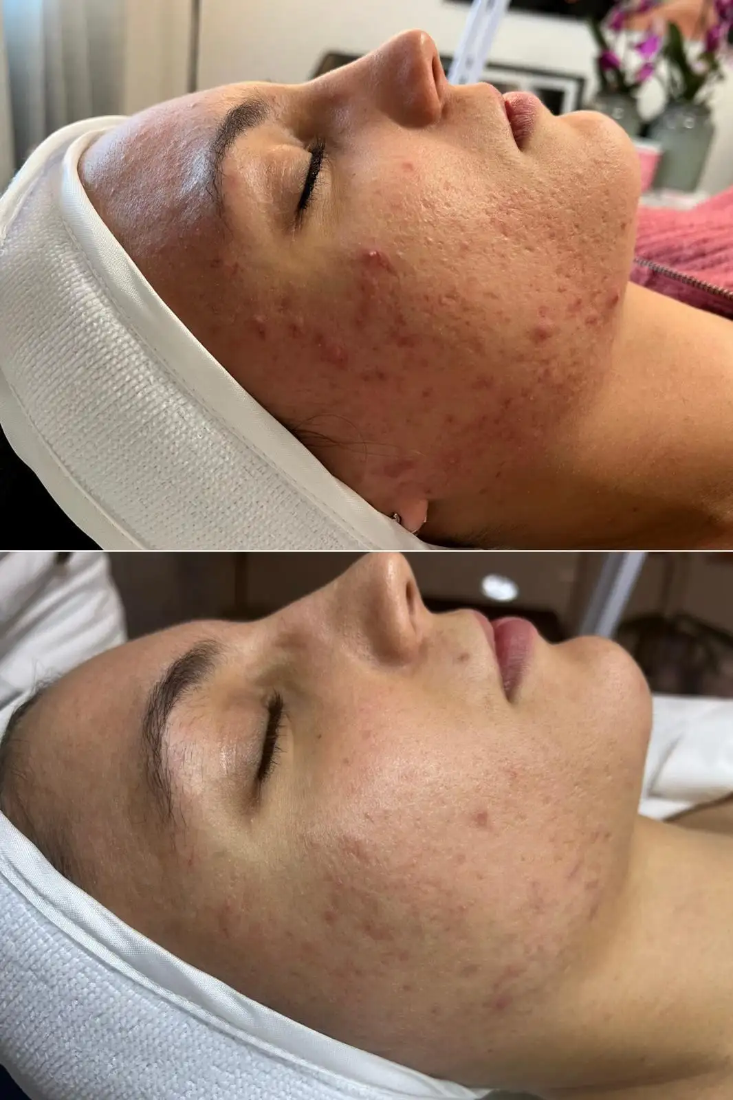 soin-du-visage-aix-en-provence-nettoyage-peau