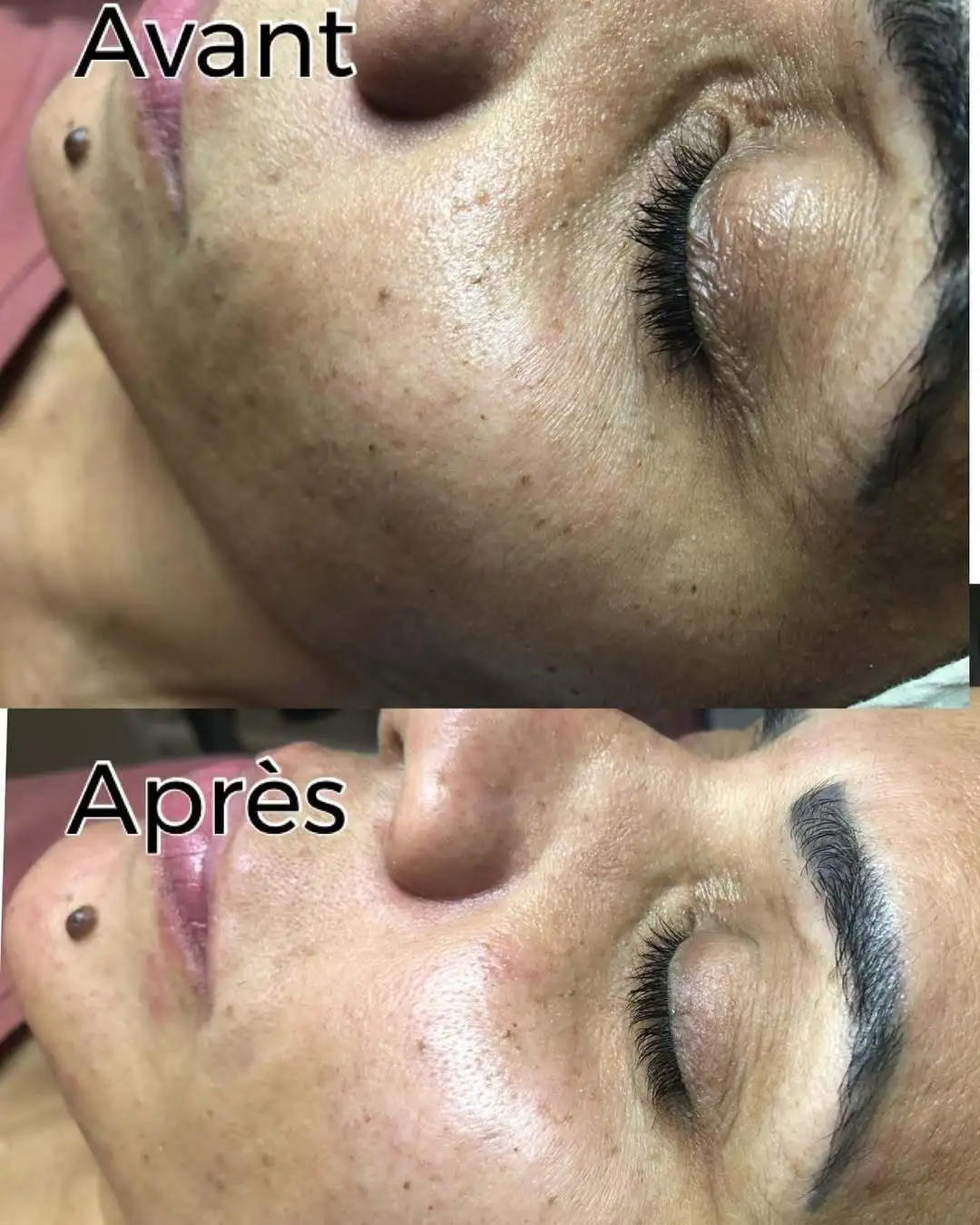 soin-du-visage-aix-en-provence-dermatologique