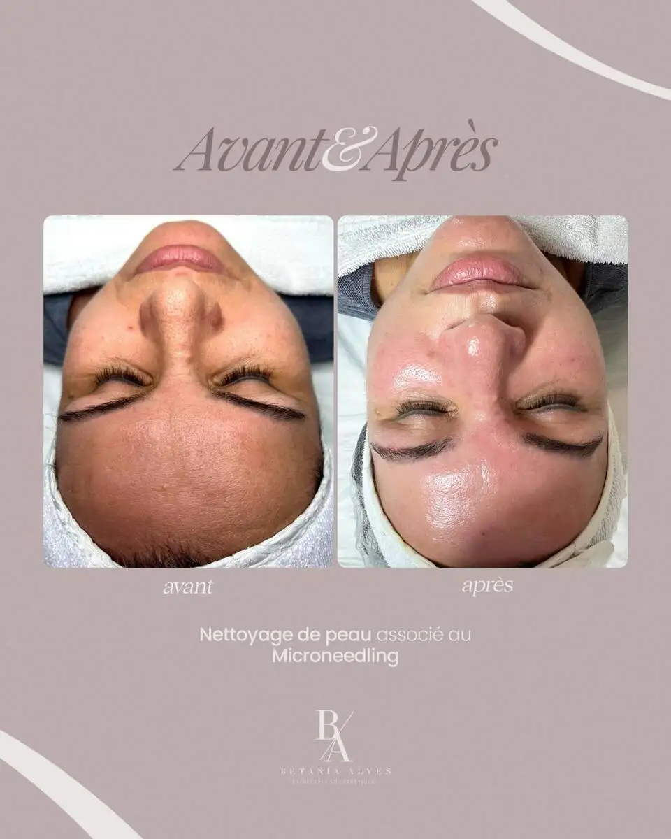 Comment garder une peau parfaite entre vos soins ? Les solutions de notre institut � Aix-en-Provence