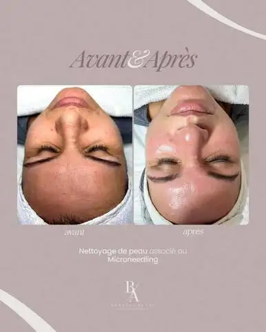 Comment garder une peau parfaite entre vos soins ? Les solutions de notre institut � Aix-en-Provence